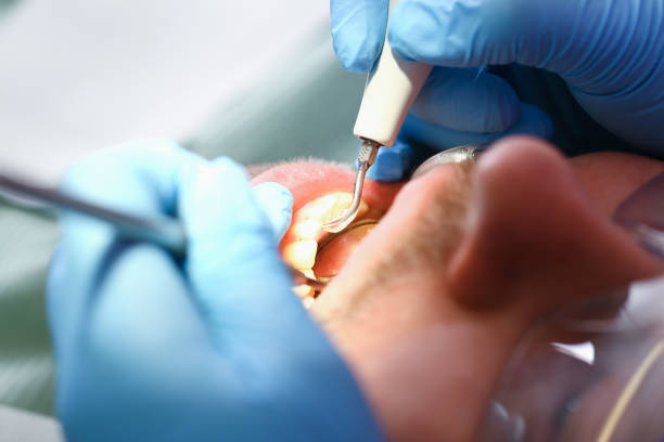 Best Emergency Dental Care for Abscessed Tooth in Benton Park, CA